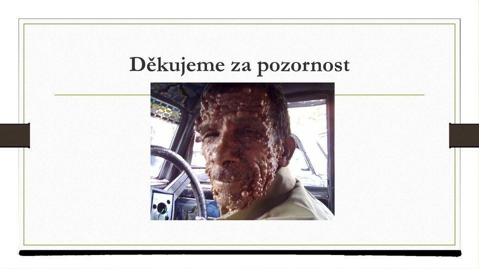 pozornost