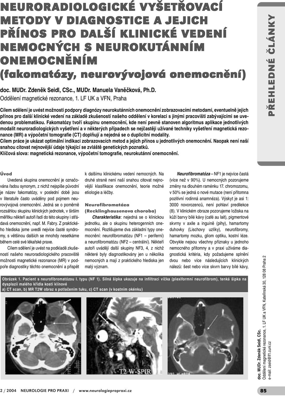 LF UK a VFN, Praha Cílem sdělení je uvést možnosti podpory diagnózy neurokutánních onemocnění zobrazovacími metodami, eventuelně jejich přínos pro další klinické vedení na základě zkušeností našeho