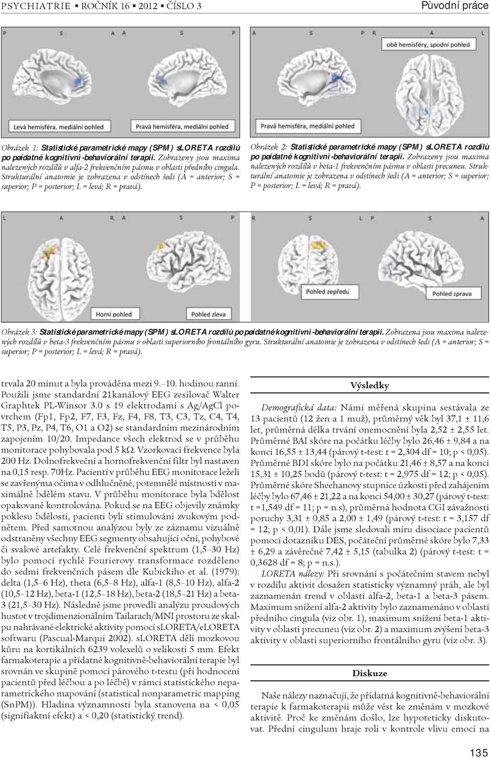 Strukturální anatomie je zobrazena v odstínech šedi (A = anterior; S = superior; P = posterior; L = levá; R = pravá).