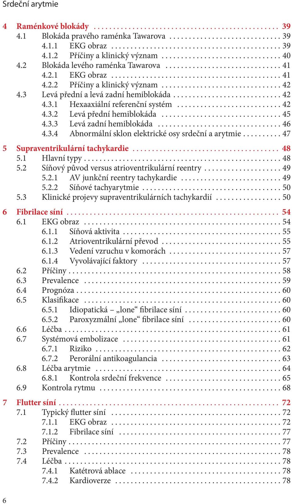 ..47 5 Supraventrikulární tachykardie... 48 5.1 Hlavní typy...48 5.2 Síňový původ versus atrioventrikulární reentry...49 5.2.1 AV junkční reentry tachykardie...49 5.2.2 Síňové tachyarytmie...50 5.