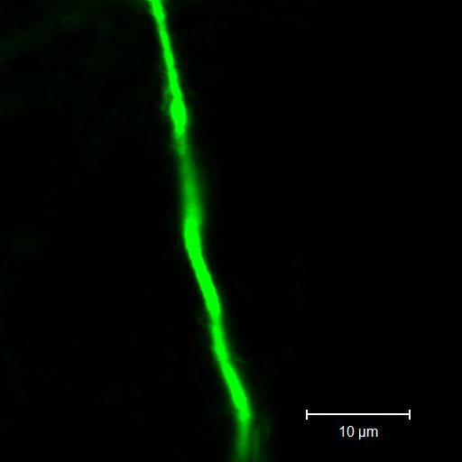 Koaxiální nanovlákna a dodávání látek - Inkorporace aktivních látek: léčivá, proteiny, DNA, buňky, lipozomy - Rozdílné látky v