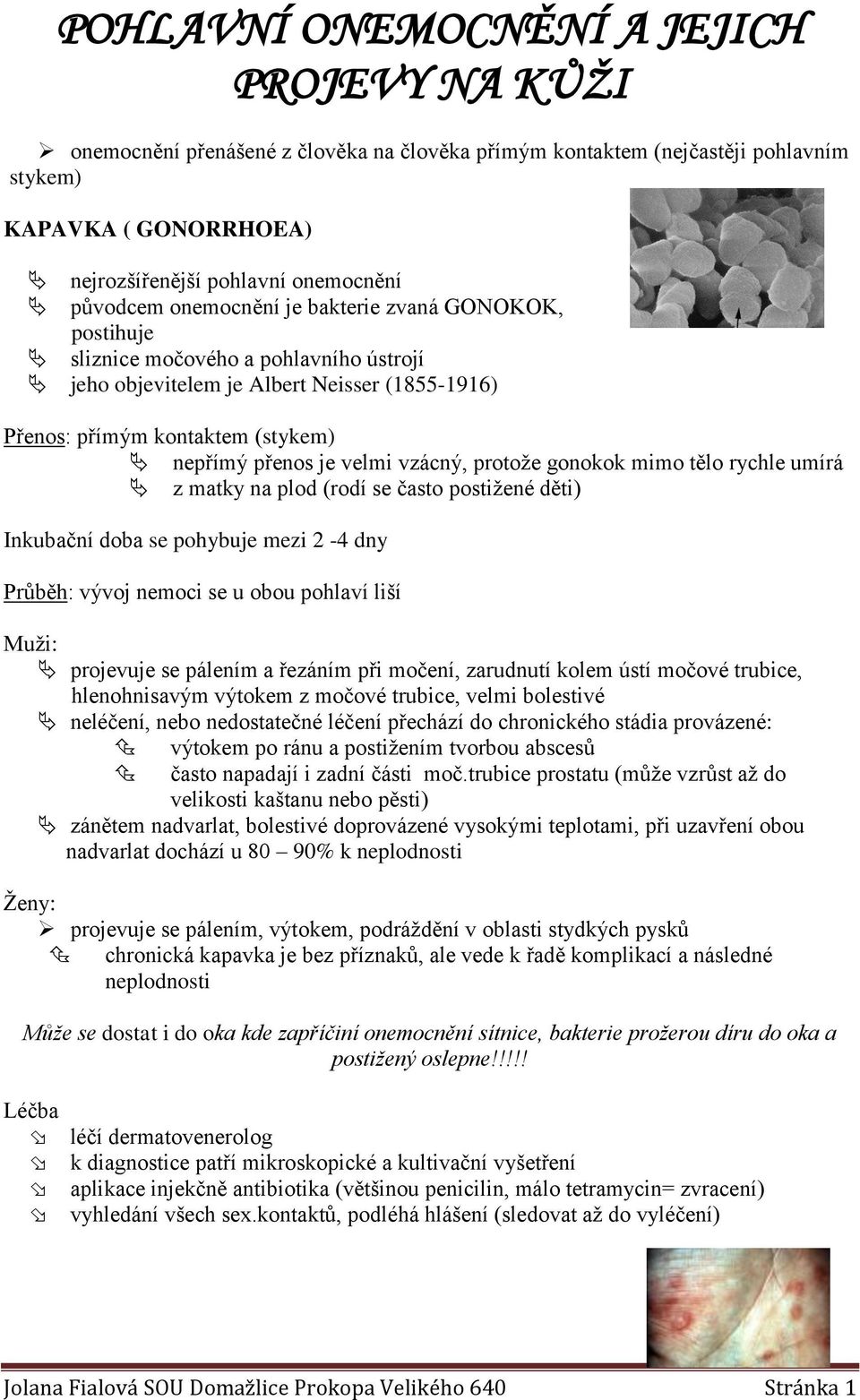 vzácný, protože gonokok mimo tělo rychle umírá z matky na plod (rodí se často postižené děti) Inkubační doba se pohybuje mezi 2-4 dny Průběh: vývoj nemoci se u obou pohlaví liší Muži: projevuje se