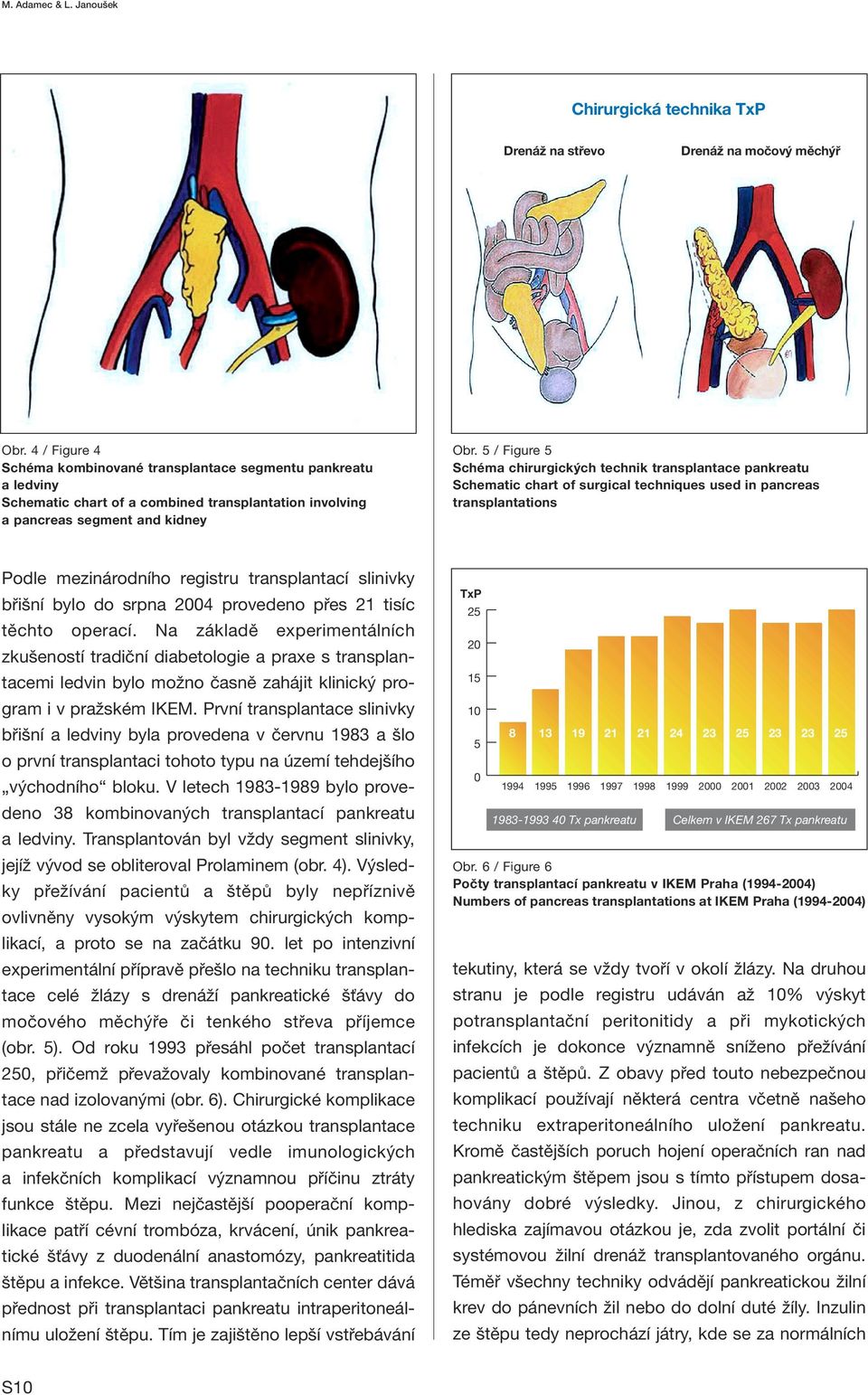 5 / Figure 5 Schéma chirurgických technik transplantace pankreatu Schematic chart of surgical techniques used in pancreas transplantations Podle mezinárodního registru transplantací slinivky břišní