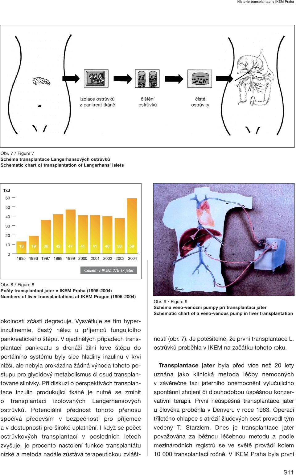 IKEM 376 Tx jater Obr. 8 / Figure 8 Počty transplantací jater v IKEM Praha (1995-4) Numbers of liver transplantations at IKEM Prague (1995-4) Obr.