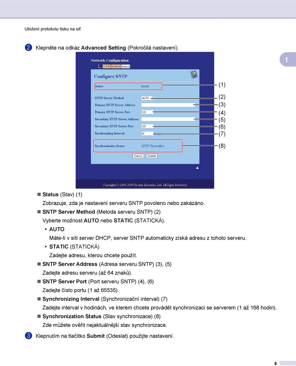 STATIC (STATICKÁ) Zadejte adresu, kterou chcete použít. SNTP Server Address (Adresa serveru SNTP) (3), (5) Zadejte adresu serveru (až 64 znaků).