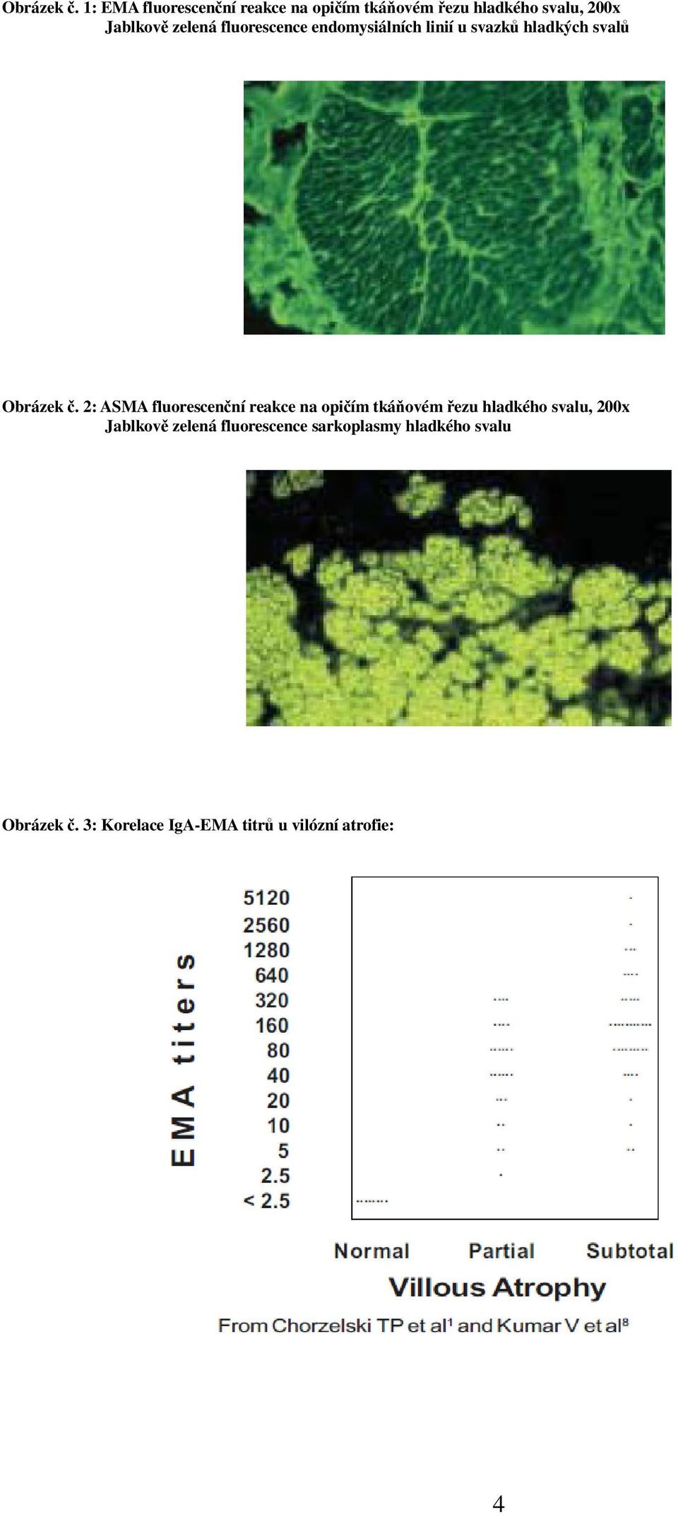 fluorescence endomysiálních linií u svazků hladkých svalů  2: ASMA fluorescenční reakce