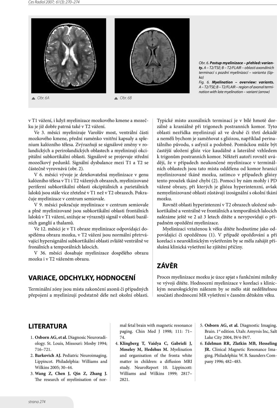 měsíci myelinizuje Varolův most, ventrální části mozkového kmene, přední raménko vnitřní kapsuly a splenium kalózního tělesa.