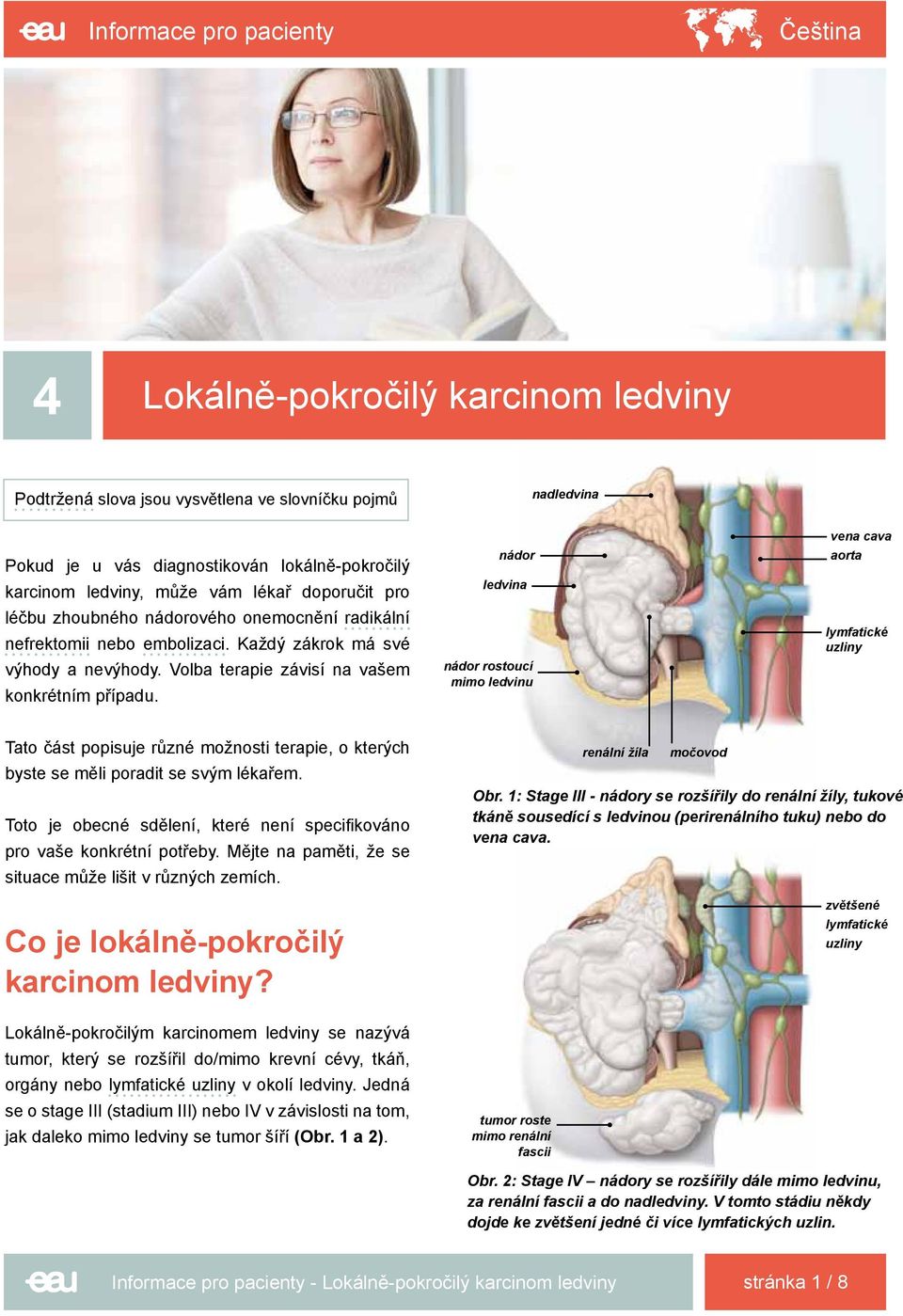 nádor ledvina nádor rostoucí mimo ledvinu vena cava aorta lymfatické uzliny Tato část popisuje různé možnosti terapie, o kterých byste se měli poradit se svým lékařem.