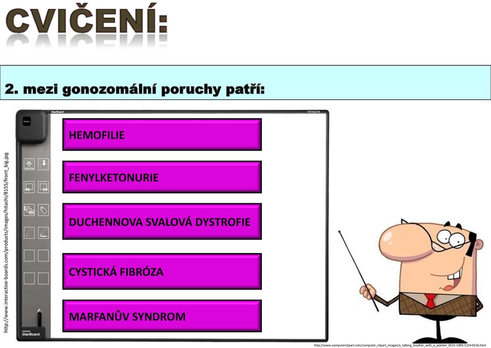 mezi gonozomální poruchy patří: HEMOFILIE FENYLKETONURIE DUCHENNOVA SVALOVÁ