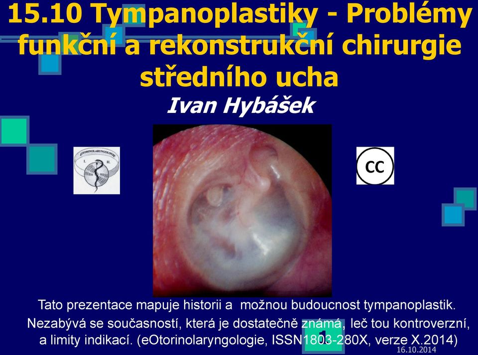 tympanoplastik.