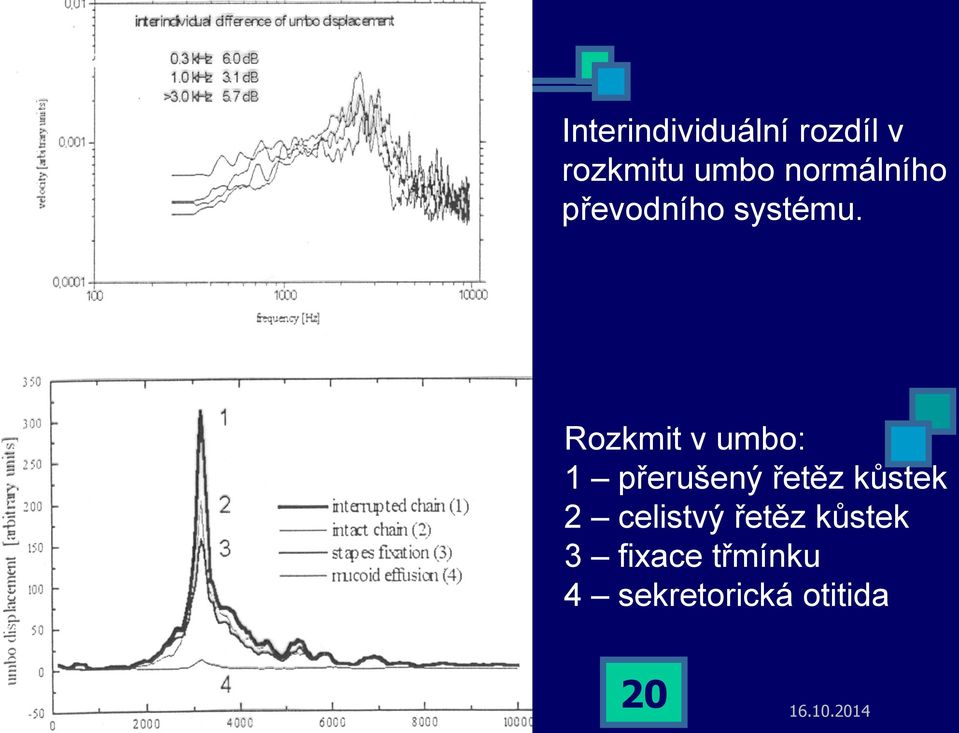 Rozkmit v umbo: 1 přerušený řetěz kůstek 2