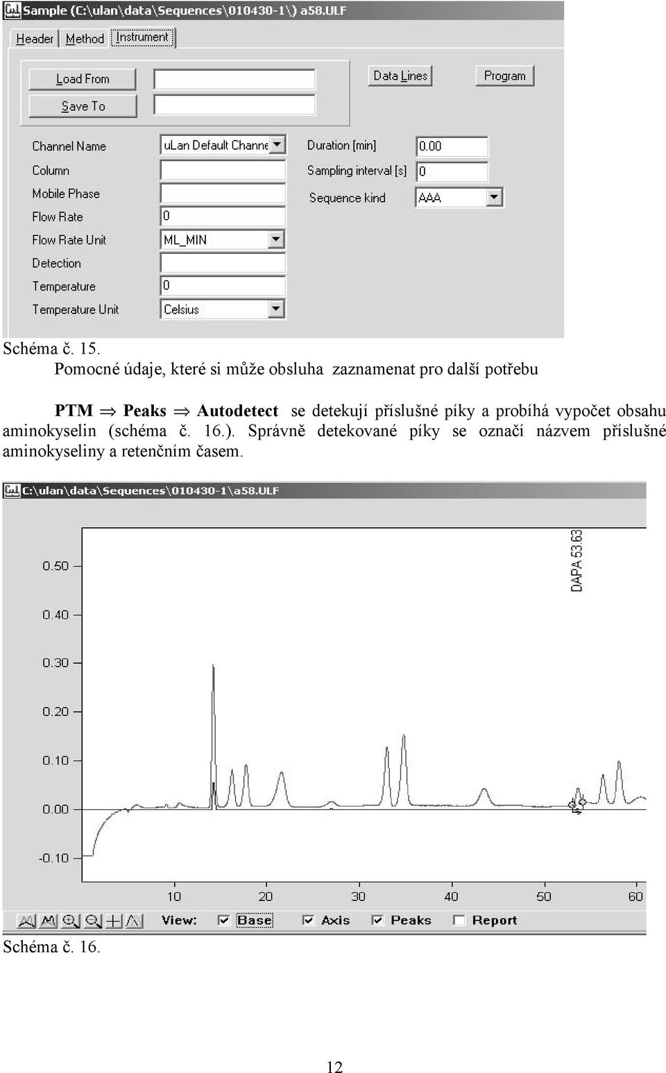 Peaks Autodetect se detekují příslušné píky a probíhá vypočet obsahu