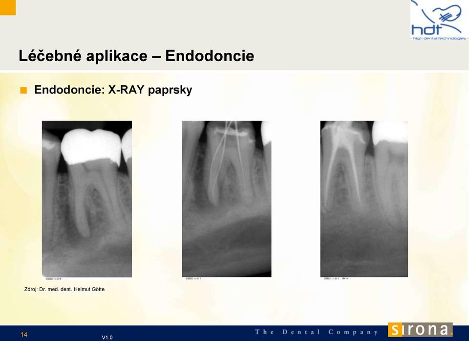 X-RAY paprsky Zdroj: