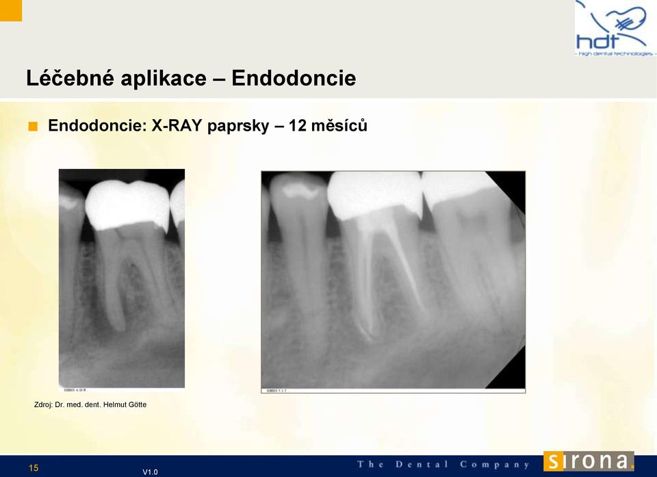 X-RAY paprsky 12 měsíců