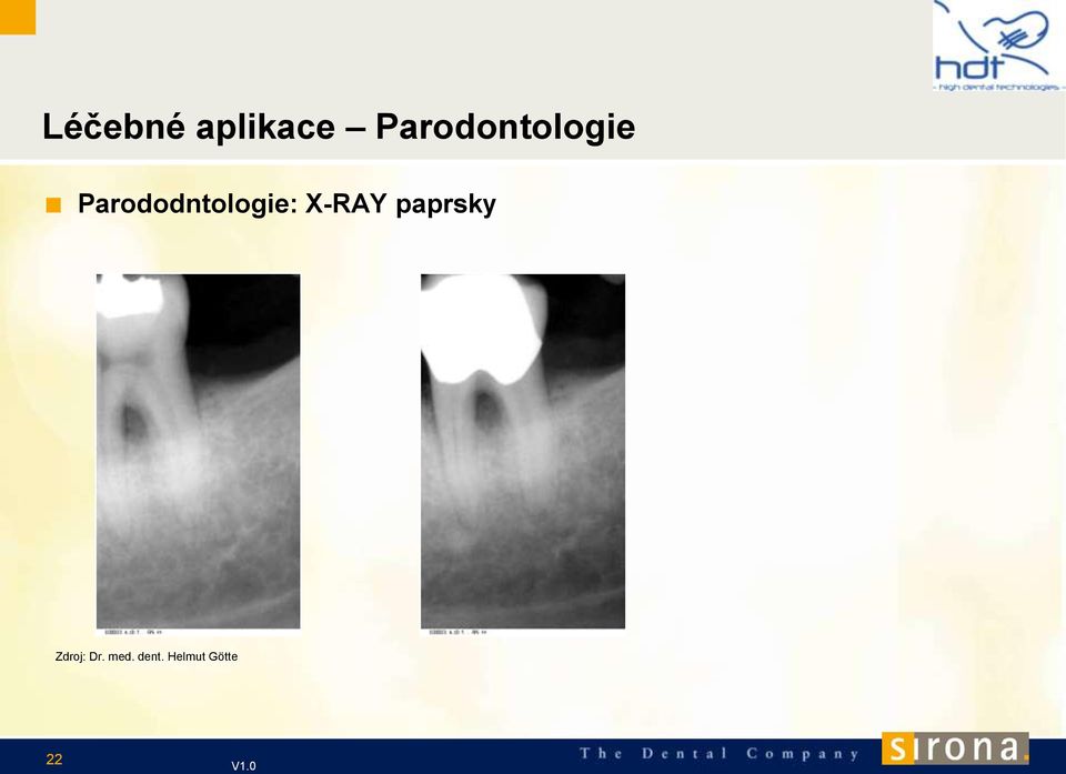 Parododntologie: X-RAY