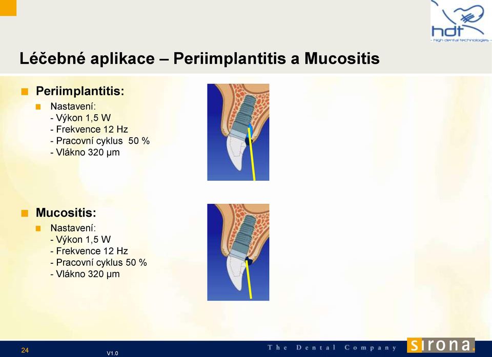 - Pracovní cyklus 50 % - Vlákno 320 µm Mucositis: