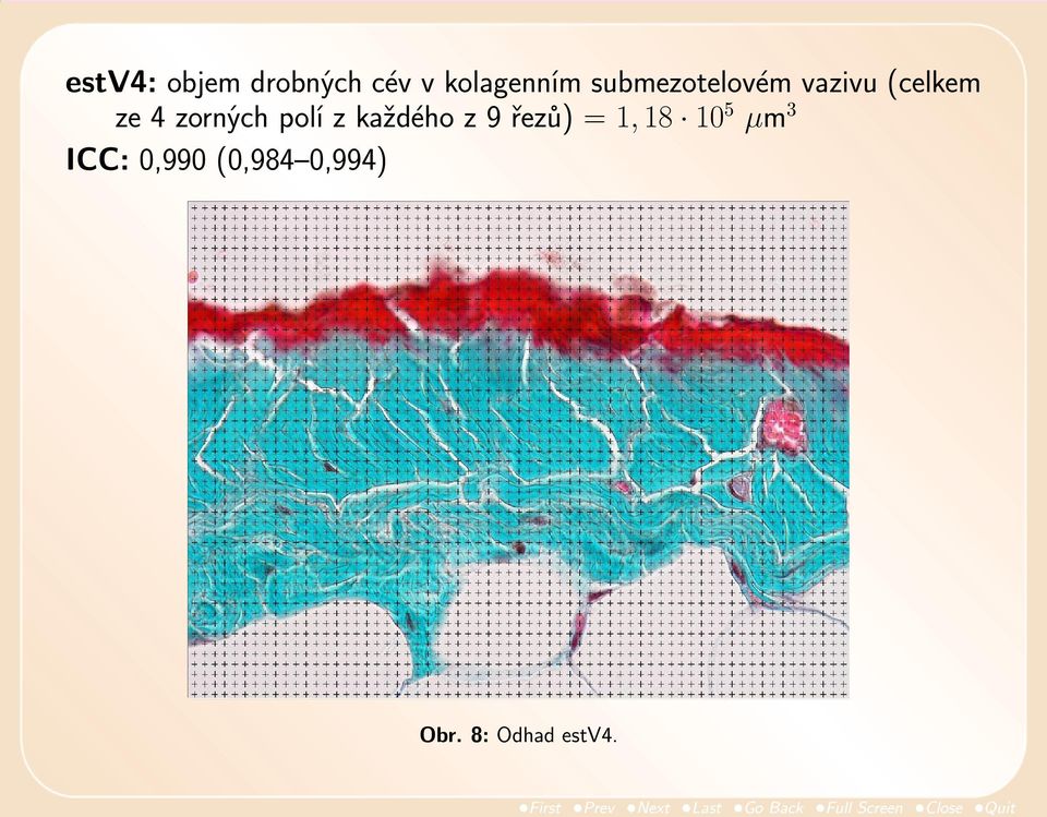 polí z každého z 9 řezů) = 1, 18 10 5 µm 3