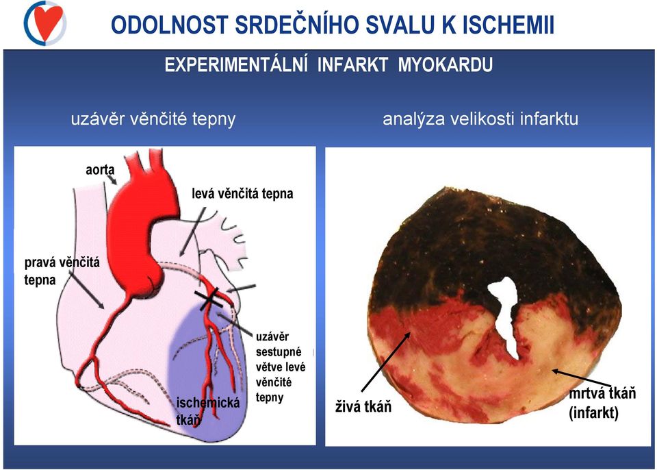aorta levá věnčitá tepna pravá věnčitá tepna ischemická tkáň