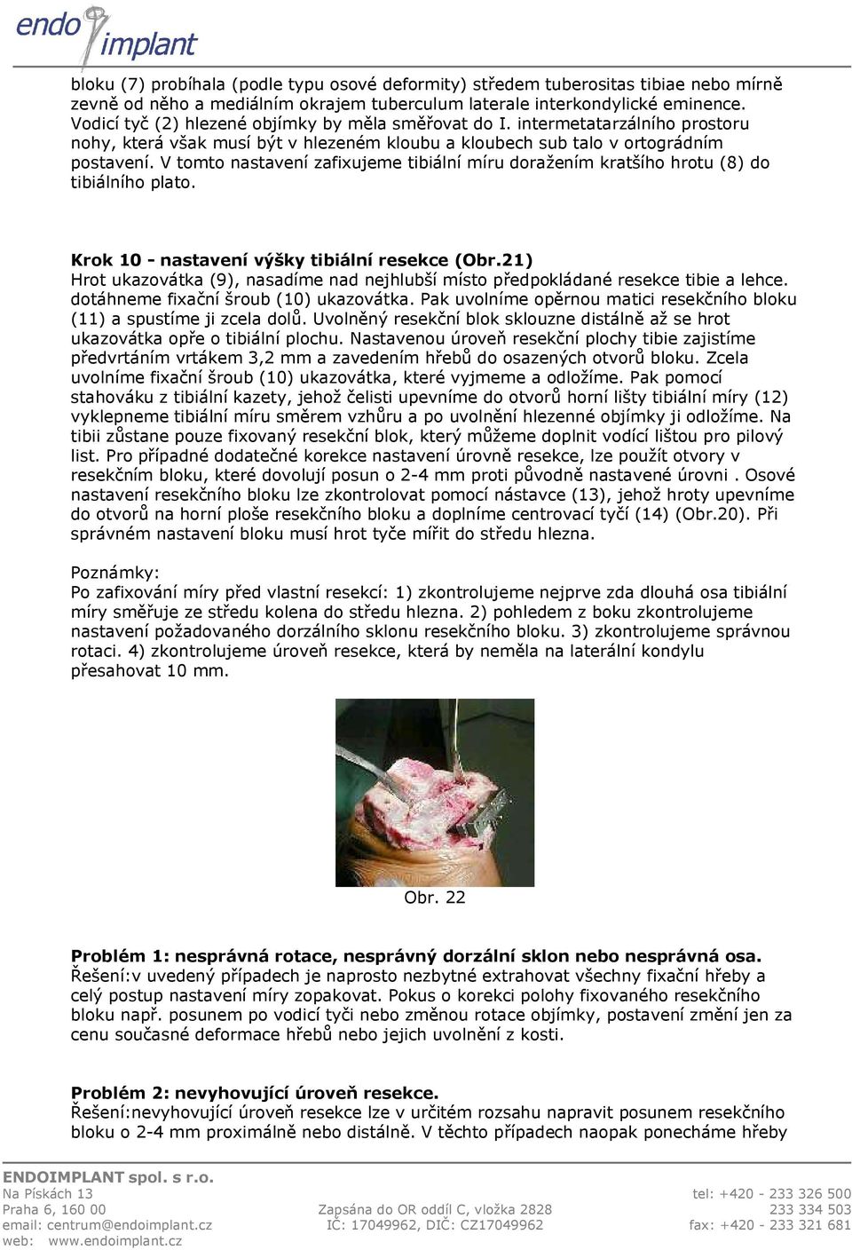 Operační technika náhrady kolenního kloubu - PDF Free Download
