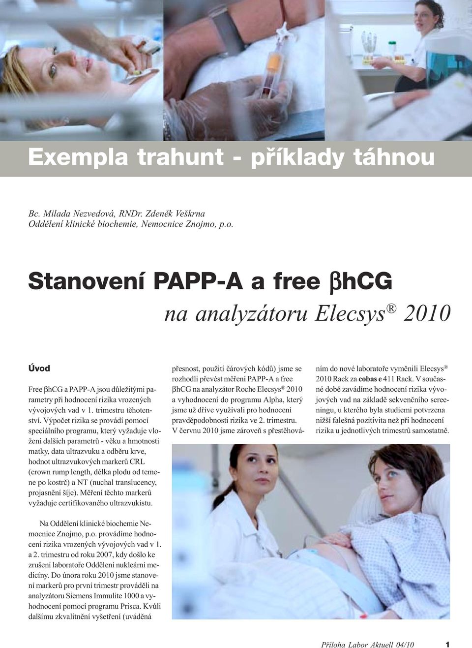 Výpoèet rizika se provádí pomocí speciálního programu, který vyžaduje vložení dalších parametrù - vìku a hmotnosti matky, data ultrazvuku a odbìru krve, hodnot ultrazvukových markerù CRL (crown rump