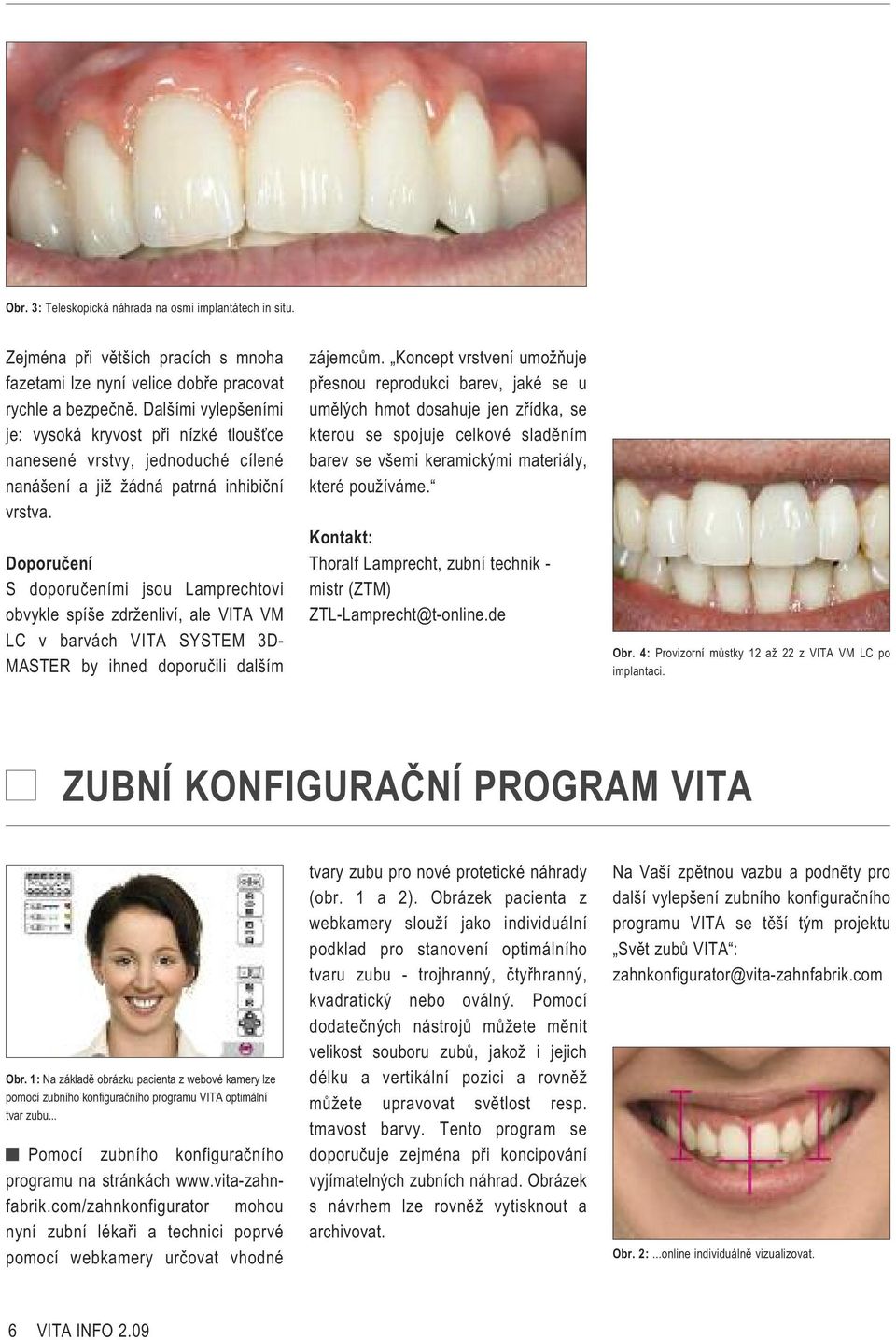 Doporučení S doporučeními jsou Lamprechtovi obvykle spíše zdrženliví, ale VITA VM LC v barvách VITA SYSTEM 3D- MASTER by ihned doporučili dalším zájemcům.
