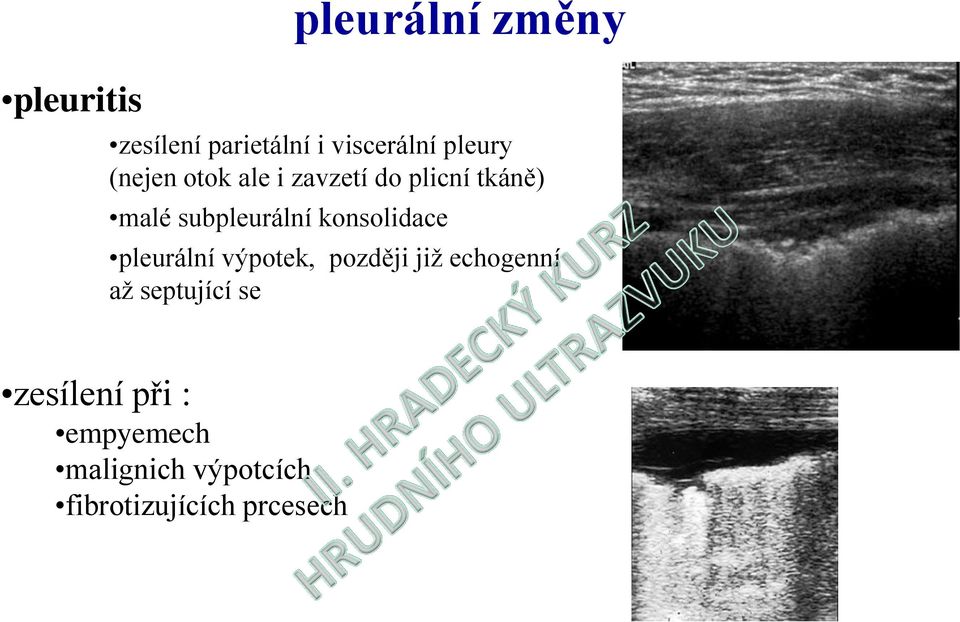 konsolidace pleurální výpotek, později již echogenní až septující