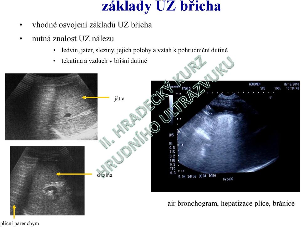 vztah k pohrudniční dutině tekutina a vzduch v břišní dutině