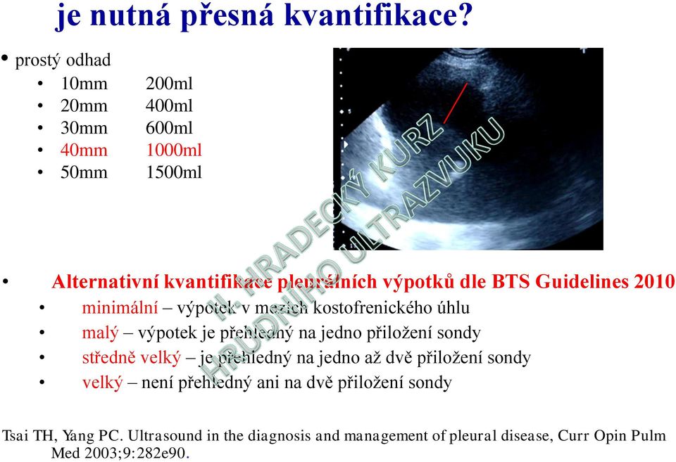 BTS Guidelines 2010 minimální výpotek v mezích kostofrenického úhlu malý výpotek je přehledný na jedno přiložení sondy