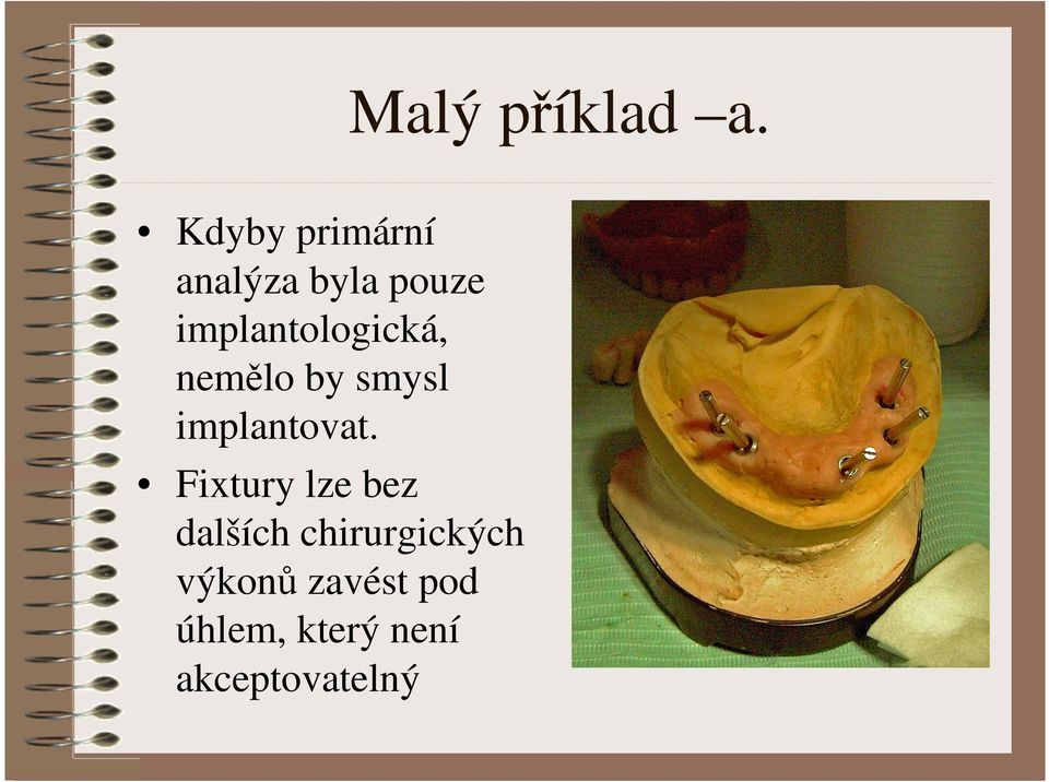implantologická, nemělo by smysl implantovat.