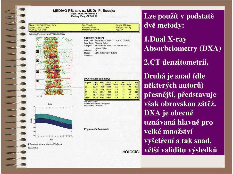 Druhá je snad (dle některých autorů) přesnější, představuje však