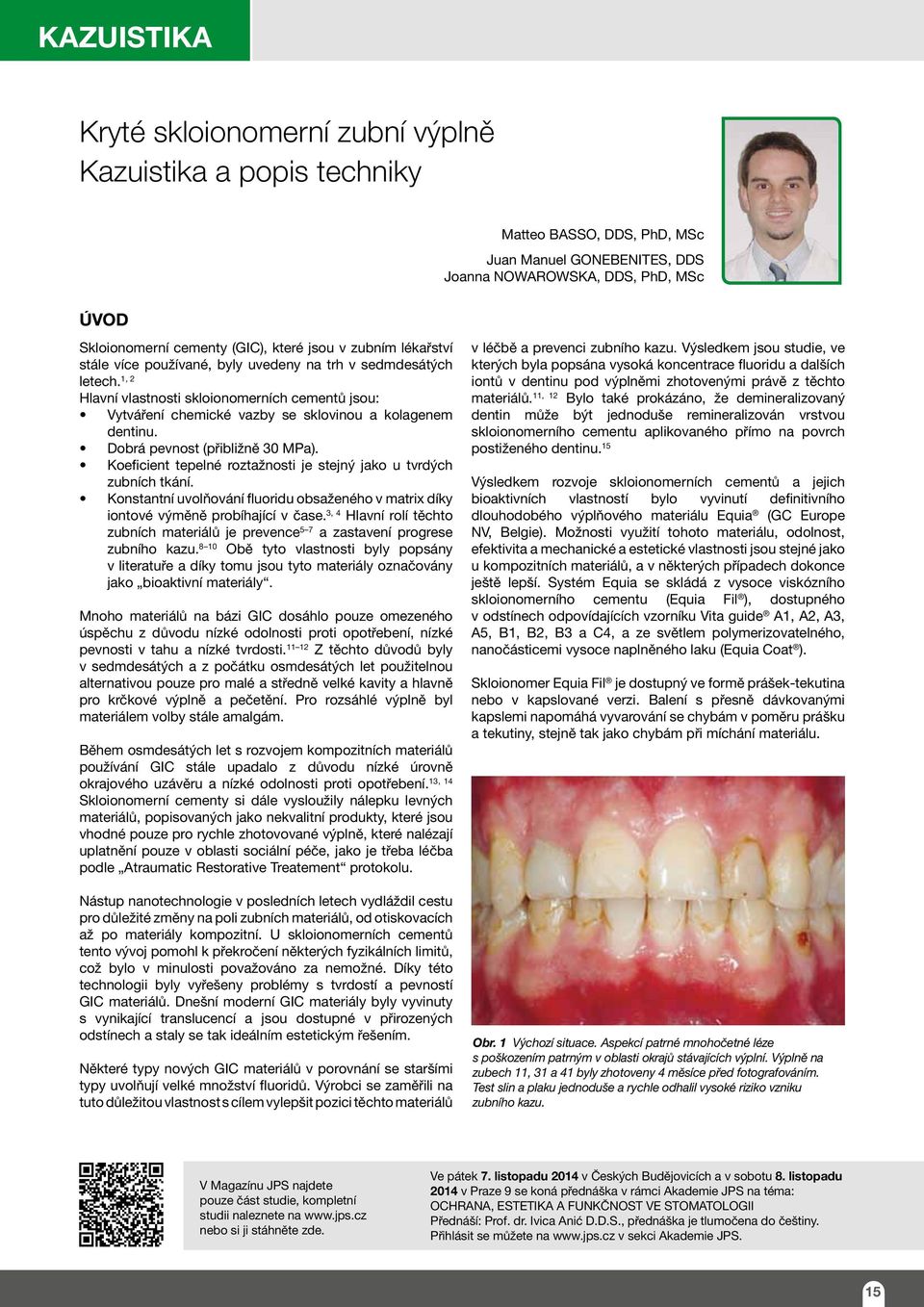 Dobrá pevnost (přibližně 30 MPa). Koeficient tepelné roztažnosti je stejný jako u tvrdých zubních tkání. Konstantní uvolňování fluoridu obsaženého v matrix díky iontové výměně probíhající v čase.