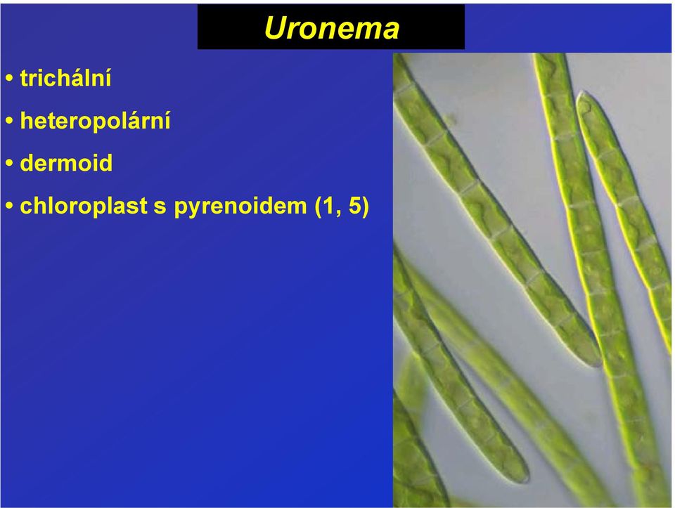 dermoid