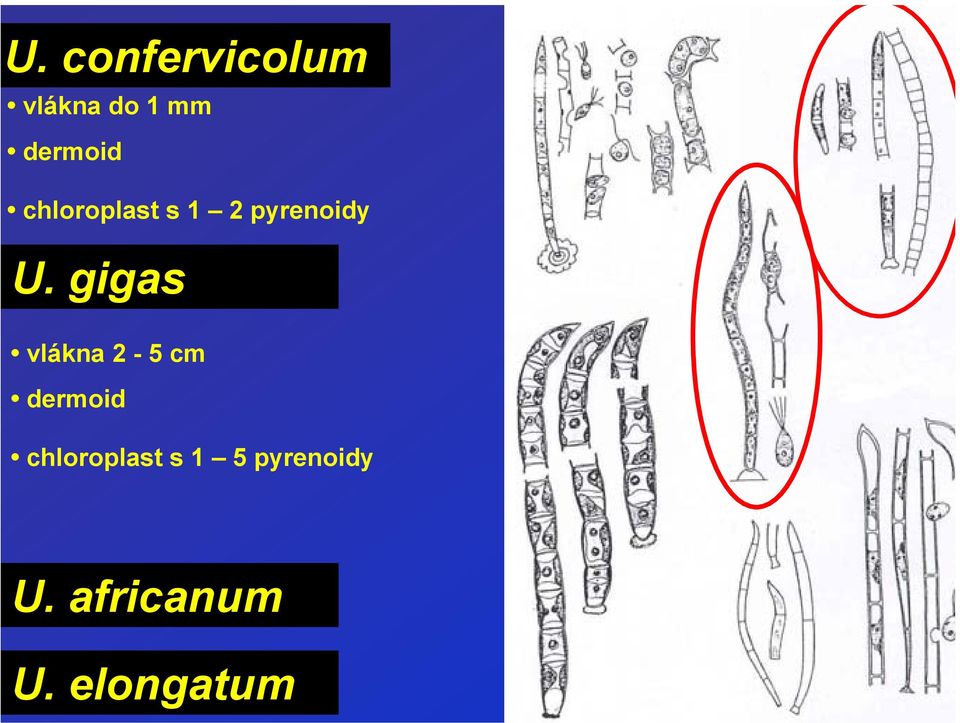 gigas vlákna 2-5 cm dermoid