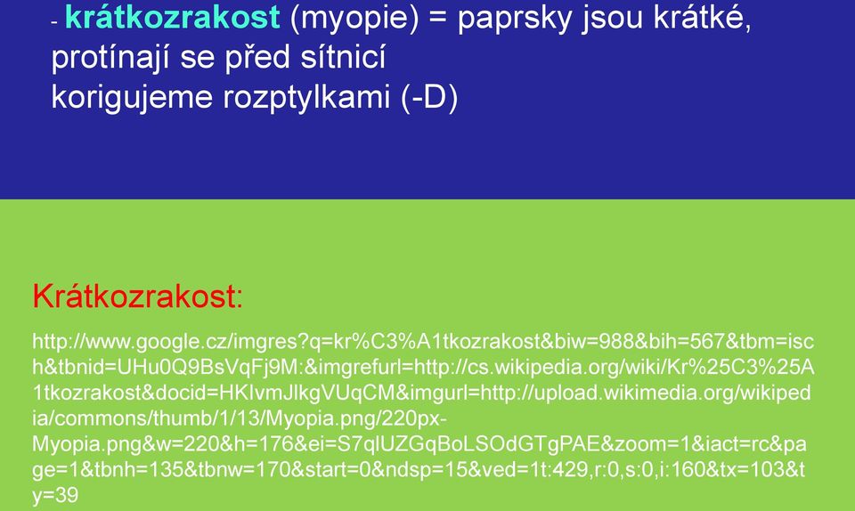 org/wiki/kr%25c3%25a 1tkozrakost&docid=HKIvmJlkgVUqCM&imgurl=http://upload.wikimedia.org/wikiped ia/commons/thumb/1/13/myopia.