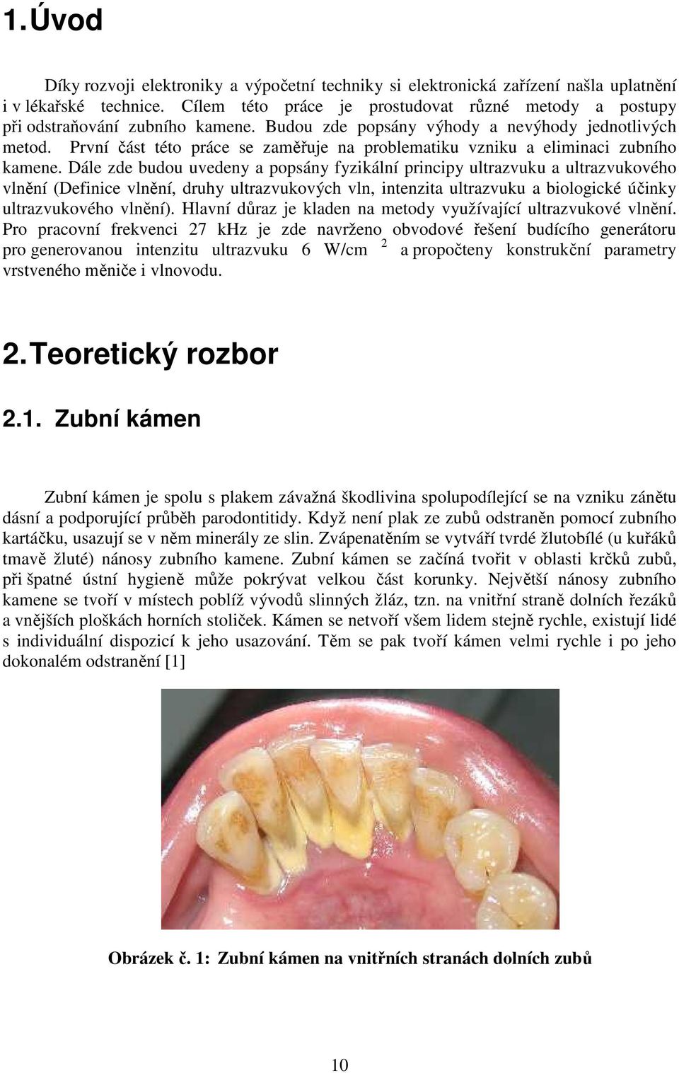 První část této práce se zaměřuje na problematiku vzniku a eliminaci zubního kamene.