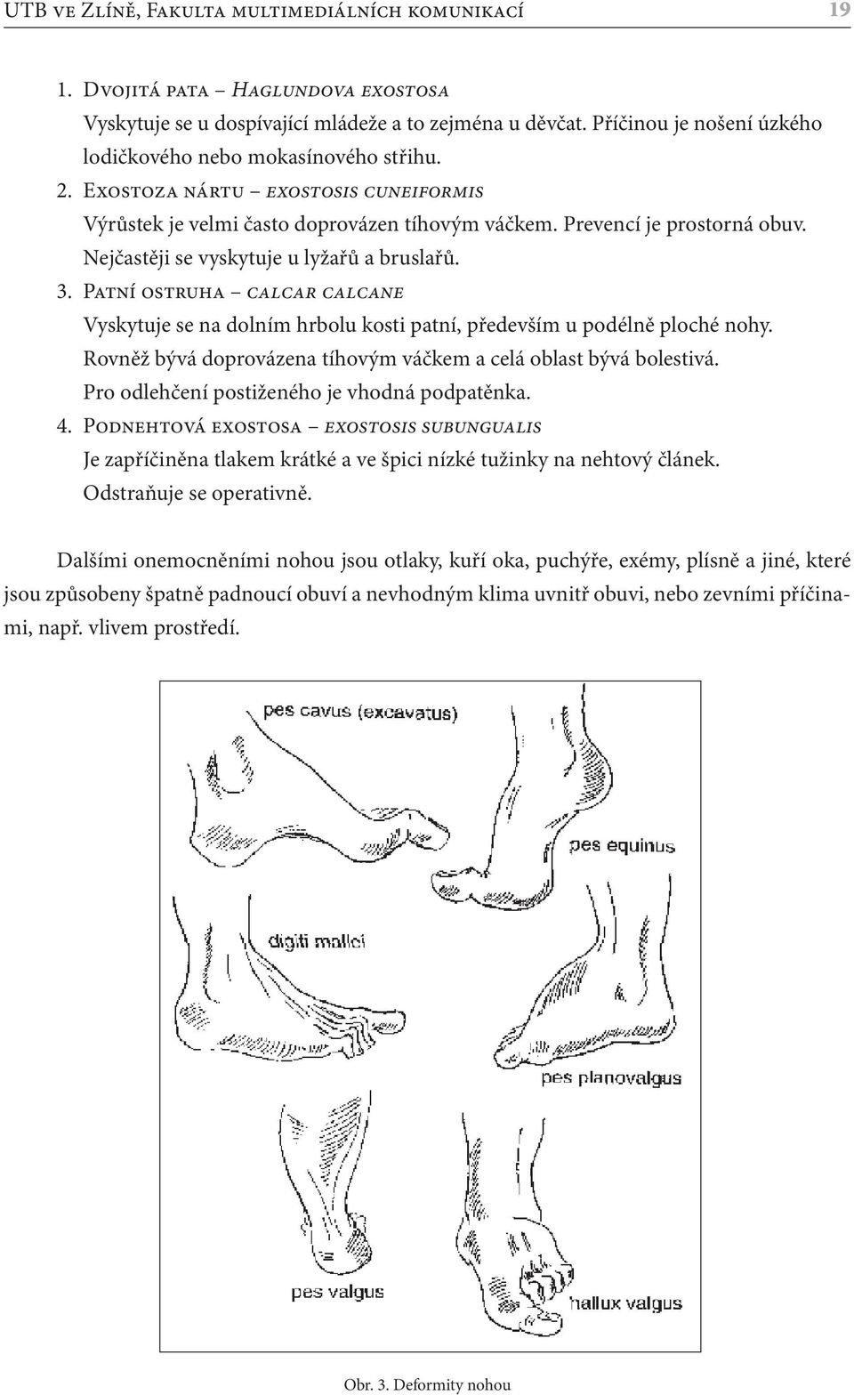 Nejčastěji se vyskytuje u lyžařů a bruslařů. 3. Patní ostruha calcar calcane Vyskytuje se na dolním hrbolu kosti patní, především u podélně ploché nohy.