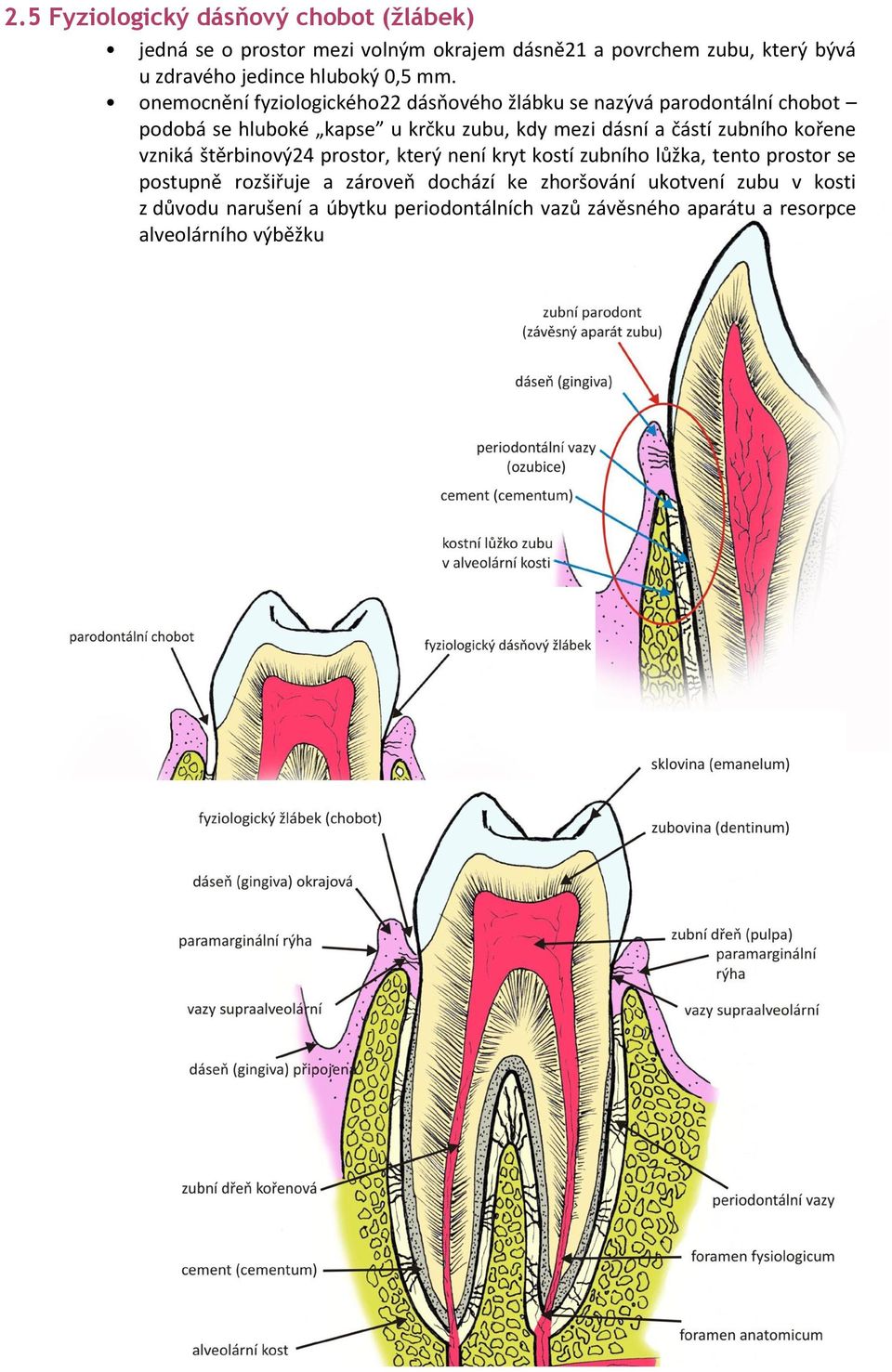 onemocnění fyziologického22 dásňového žlábku se nazývá parodontální chobot podobá se hluboké kapse u krčku zubu, kdy mezi dásní a částí