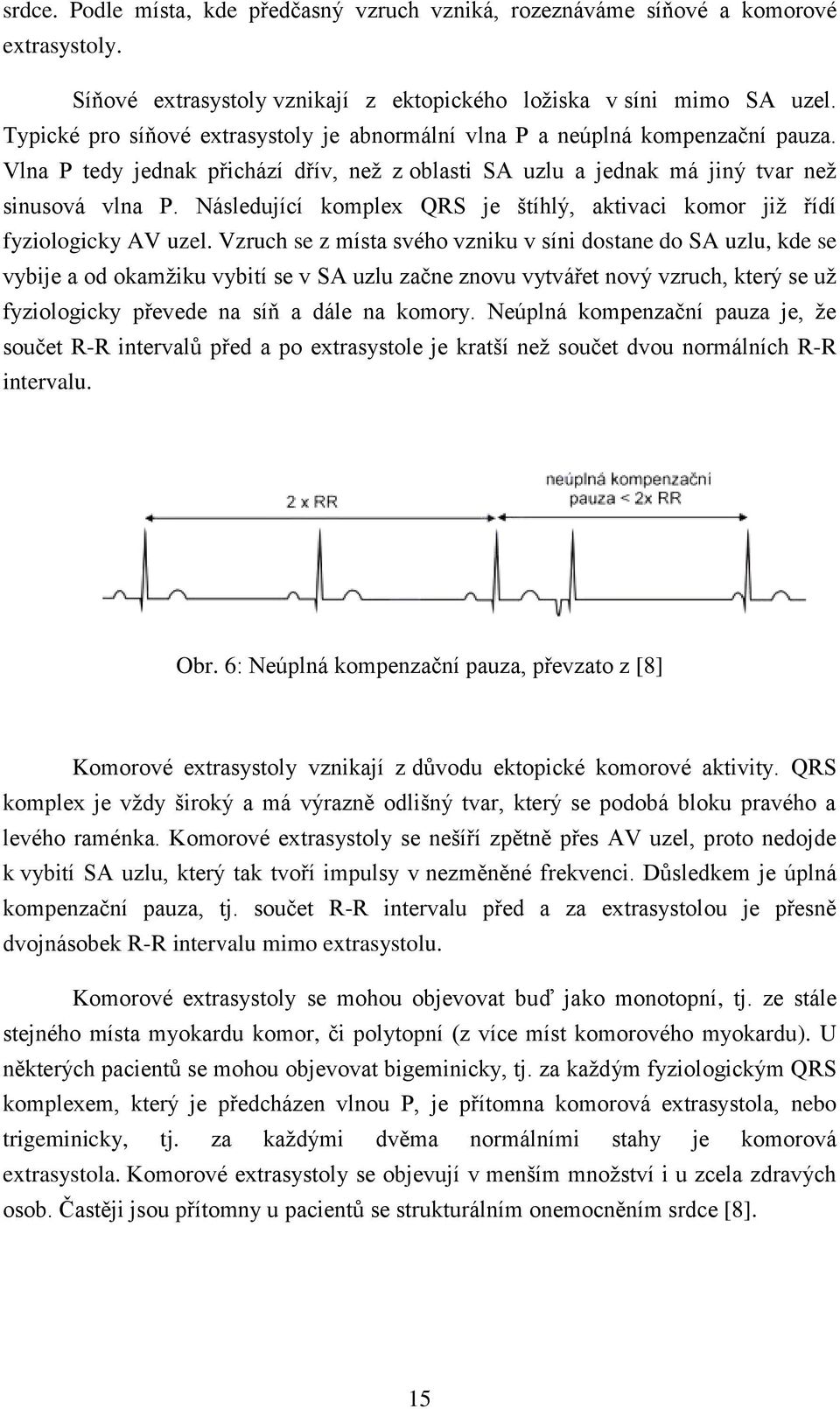 Následující komplex QRS je štíhlý, aktivaci komor již řídí fyziologicky AV uzel.