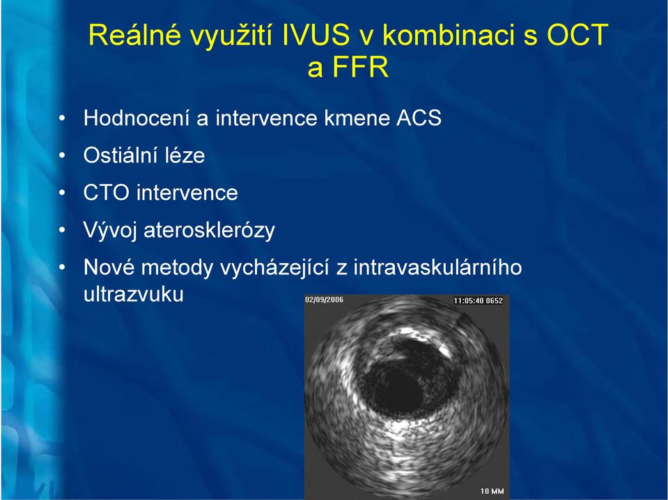 léze CTO intervence Vývoj aterosklerózy Nové