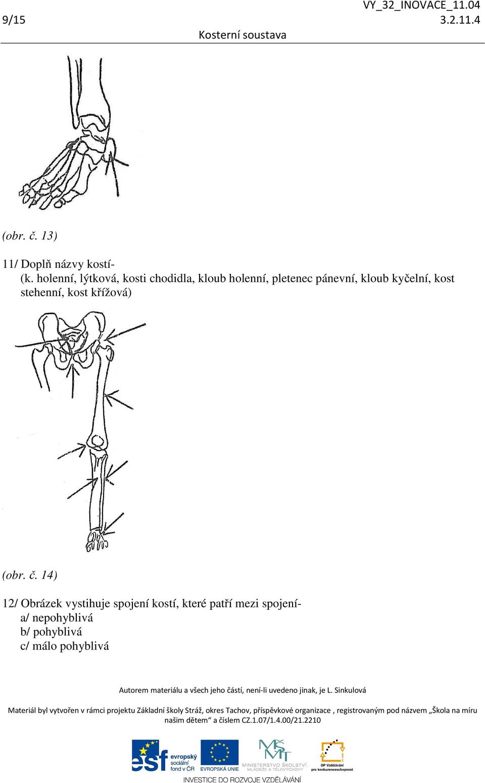 kloub kyčelní, kost stehenní, kost křížová) (obr. č.
