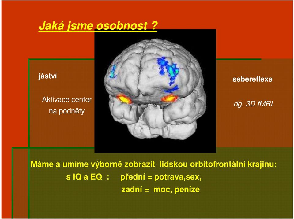 3D fmri Máme a umíme výborně zobrazit lidskou