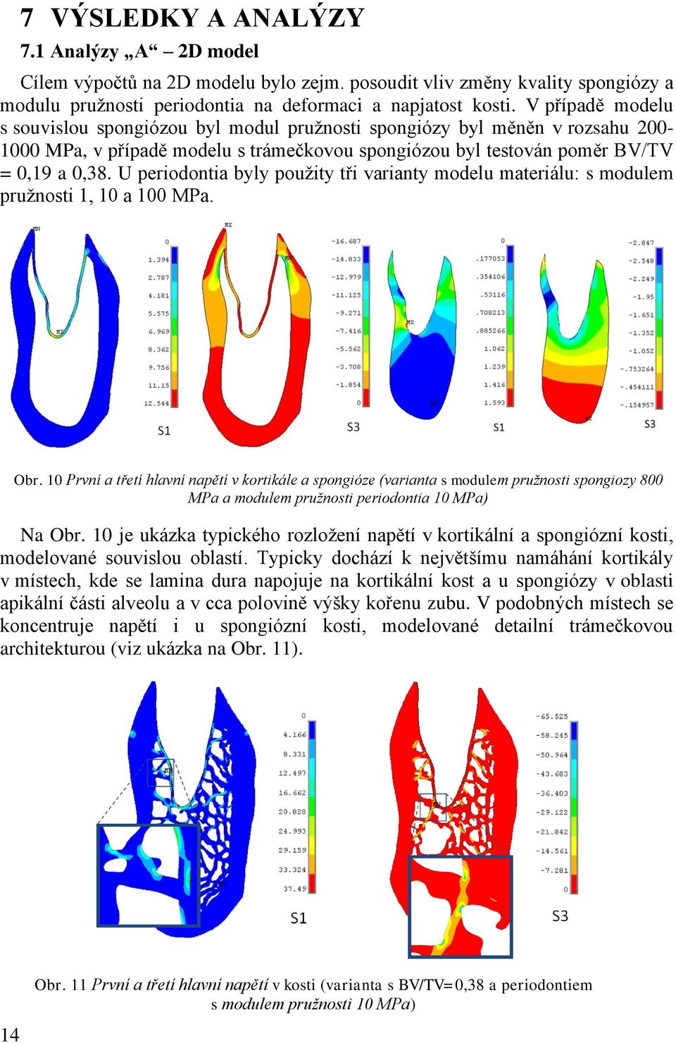 U periodontia byly pouţity tři varianty modelu materiálu: s modulem pruţnosti 1, 10 a 100 MPa. Obr.