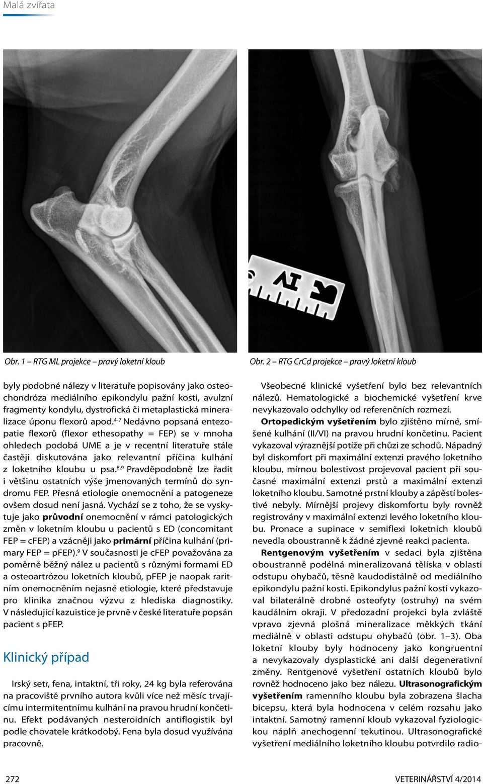 4-7 Nedávno popsaná entezopatie flexorů (flexor ethesopathy = FEP) se v mnoha ohledech podobá UME a je v recentní literatuře stále častěji diskutována jako relevantní příčina kulhání z loketního
