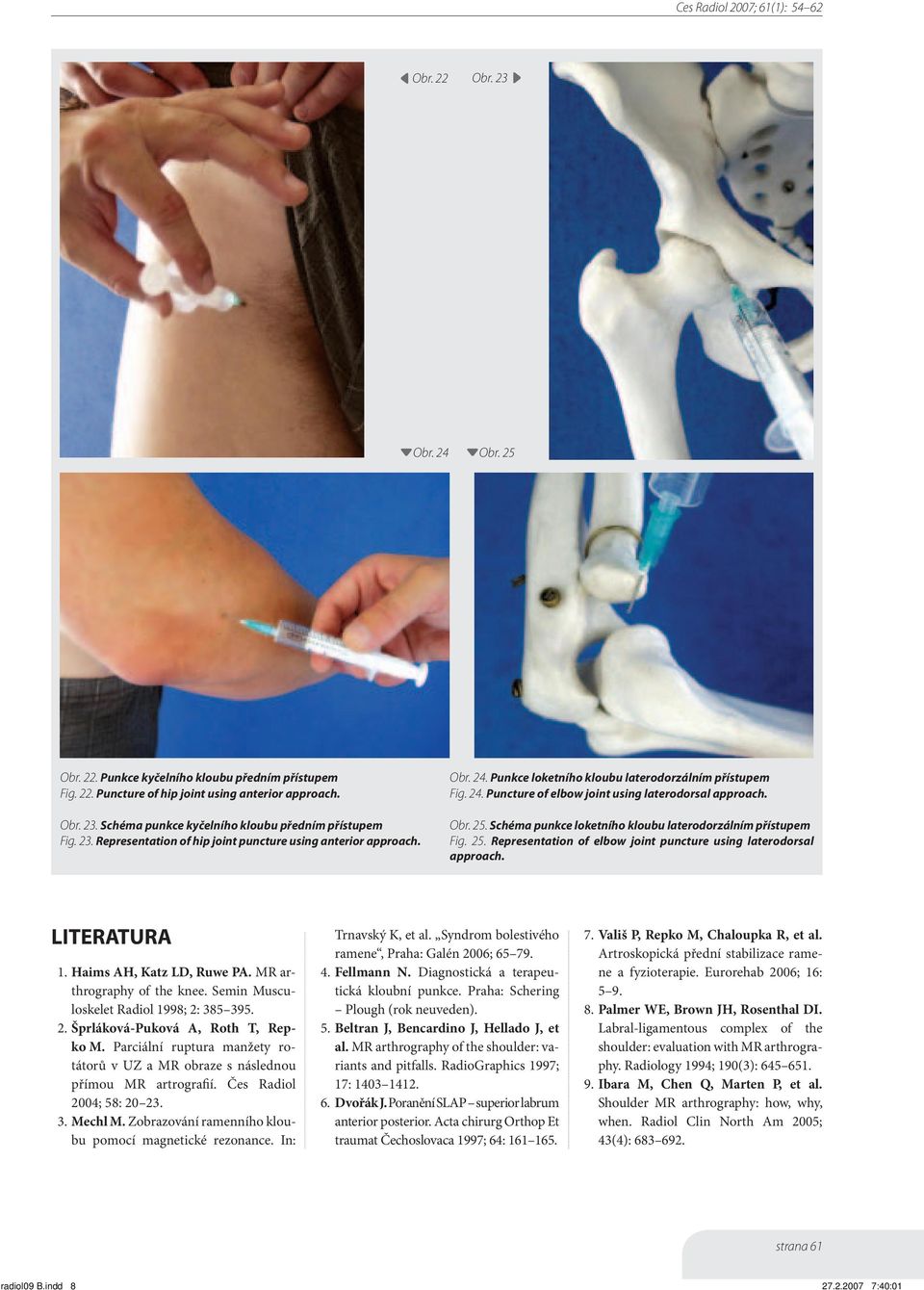 Schéma punkce loketního kloubu laterodorzálním přístupem Fig. 25. Representation of elbow joint puncture using laterodorsal approach. LITERATURA 1. Haims AH, Katz LD, Ruwe PA.