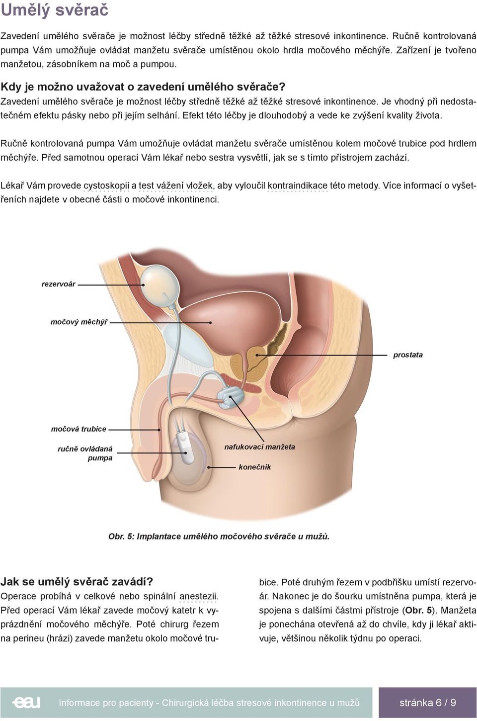Chirurgická léčba stresové inkontinence u mužů - PDF Free Download