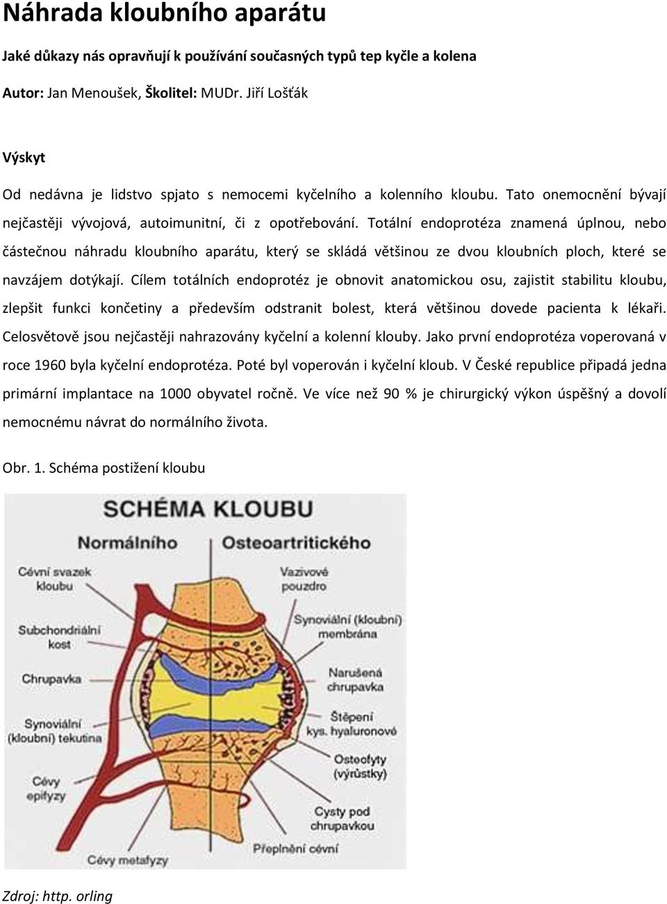 Totální endoprotéza znamená úplnou, nebo částečnou náhradu kloubního aparátu, který se skládá většinou ze dvou kloubních ploch, které se navzájem dotýkají.
