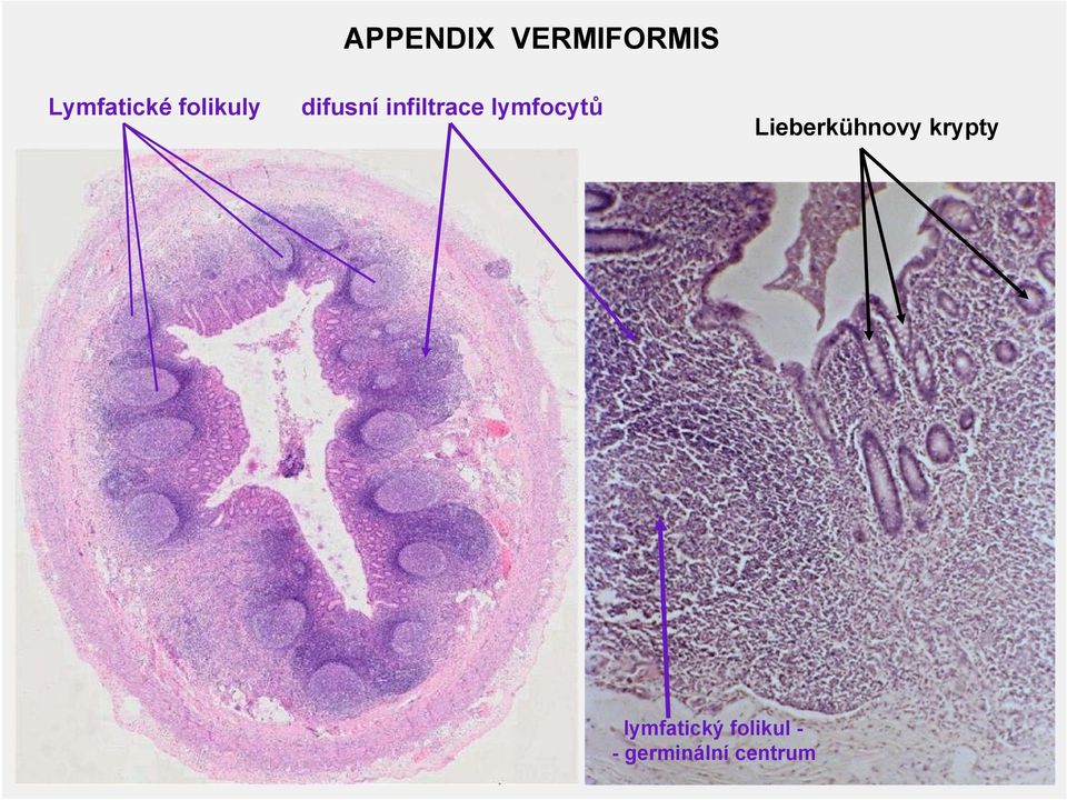 lymfocytů Lieberkühnovy krypty