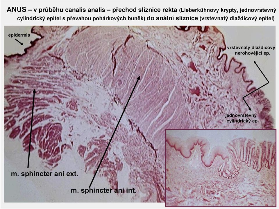 sliznice (vrstevnatý dlaždicový epitel) epidermis vrstevnatý dlaždicový