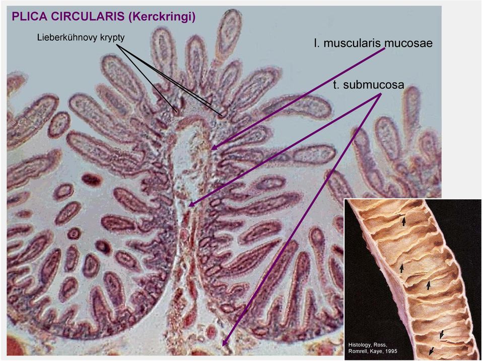 muscularis mucosae t.