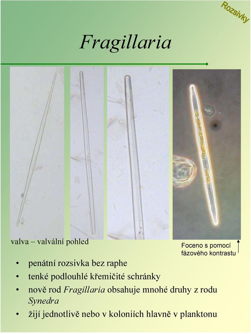 fázového kontrastu nově rod Fragillaria obsahuje mnohé